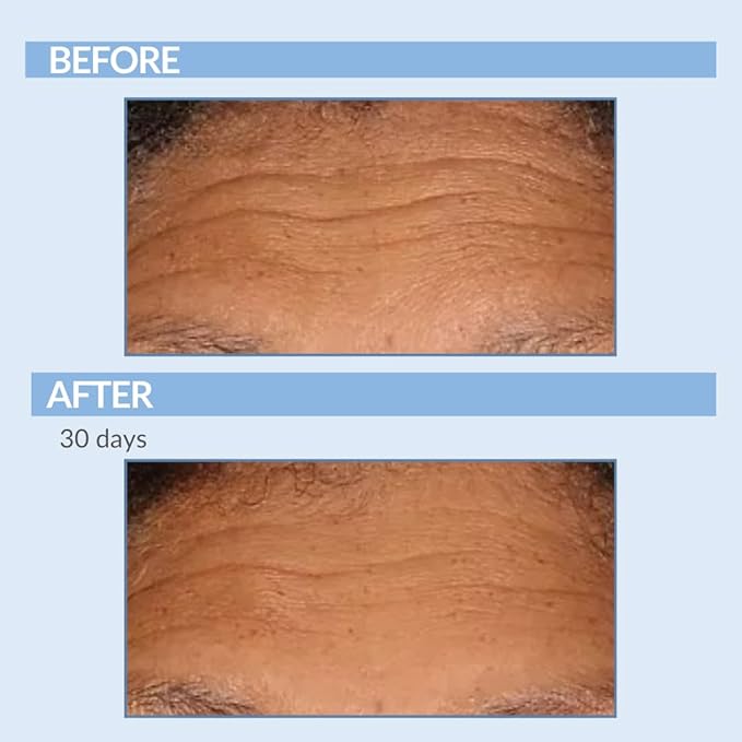 Serious Skincare Retinol Vitamin A Cream XR Premium Moisturizer for Face & Neck 2 fl oz, Anti-Aging - Day & Night - Reduce Fine Lines & Wrinkles - For Radiant Skin Set of 2