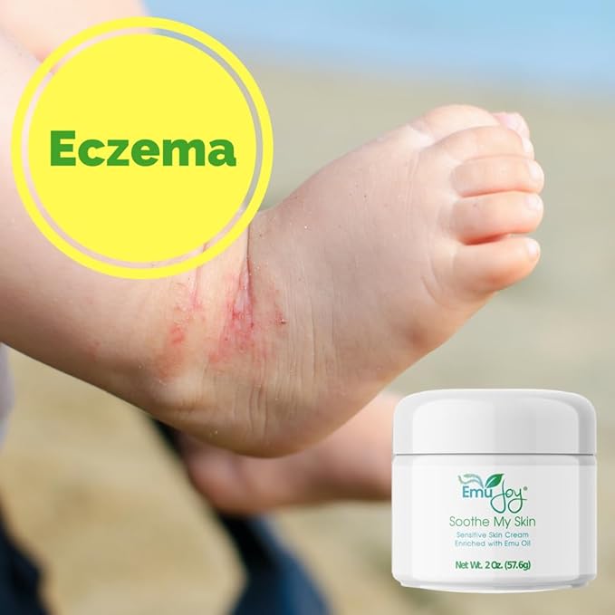 Soothe My Skin Cream for Sensitive Skin - Stocking Stuffers. Eczema Cream Psoriasis Atopic Dermatitis Lichen Sclerosus. Emu Oil with Only Natural Ingredients