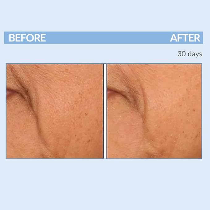 Serious Skincare Retinol Vitamin A Cream XR Premium Moisturizer for Face & Neck 2 fl oz, Anti-Aging - Day & Night - Reduce Fine Lines & Wrinkles - For Radiant Skin Set of 2