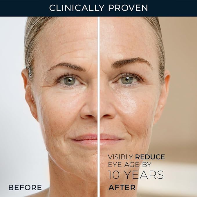 RoC Retinol Correxion Under Eye Cream for Dark Circles & Puffiness, Daily Wrinkle Cream, Anti Aging Skin Care Treatment Women and Men, 0.5 oz (Packaging May Vary)