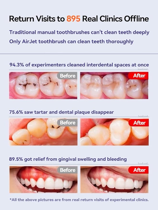 RANVOO [Vibrating & Flossing 2-in-1 Bubble Sonic Electric Toothbrush, 100% Plaque Removal, White for Adult Protect Gum Orthodontic Teeth Clean Rechargeable Gift with 2 Soft Brush Heads Grey