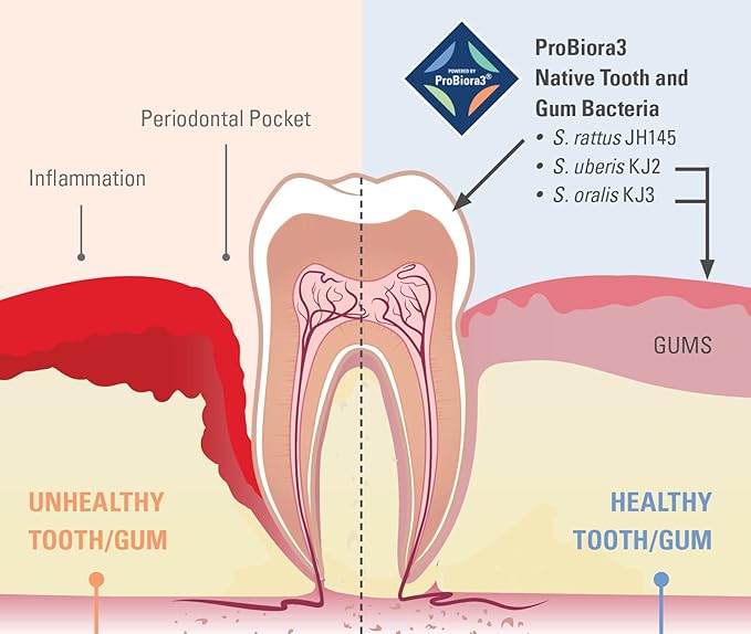 ProBiora Oral-Care Chewable Probiotic Tablets | Probiotic Supplement for Women & Men | Healthier Teeth & Gums | Fresher Breath | Whiter Teeth | 60 Count | Mint