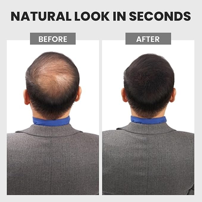 Hair Fibers Spray, Hair Building Fibers with Silicone Pump, Instant Scalp Concealer for Men & Women, Long-lasting and Sweat-proof, 1.05 oz, Dark Brown