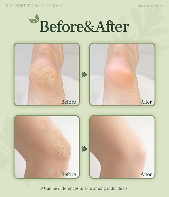 Monage Korean Organic Mugwort Bath and Foot Soak (10 Pack) Natural Home Spa Therapy with Traditional Korean Healing Properties and Relaxation Benefits, Skin Soothing, Muscle Relief, Korean Skin Care
