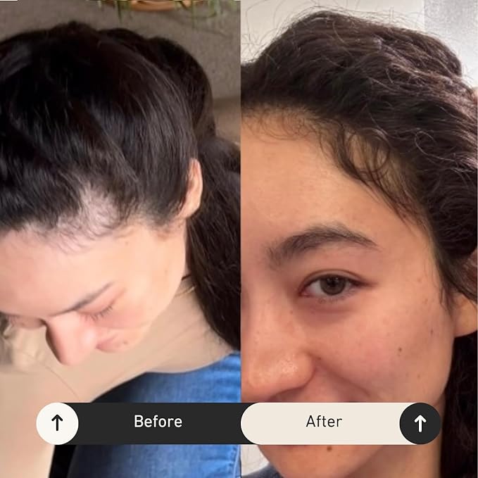 BUR BUR Growing Season Hair Growth And Repair Oil | With Burdock, Nettle Oil and Vitamin C for Visibly Fuller, Stronger and Shinier Hair.