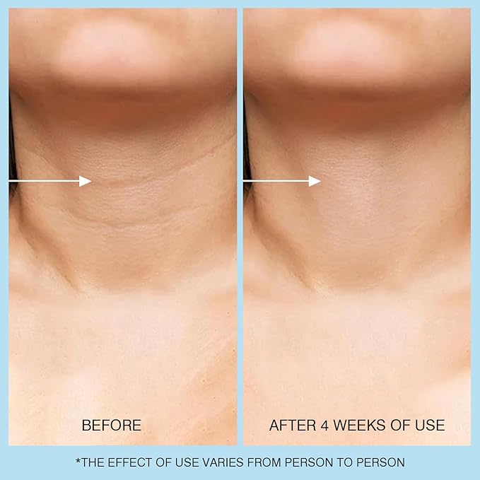 Retinol Neck Cream, Hyaluronic Acid and Caffeine Enriched Neck Firming Cream to Minimize Fine Lines & Dullness - 3-in-1 Moisturizing Cream for Neck, Chest and Face (50 ml/1.7 oz)