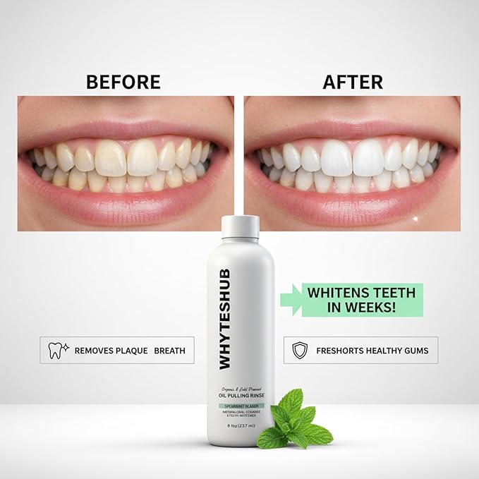 Spearmint Oil Pulling Rinse with Organic Cold-Pressed Coconut Oil, Helps Maintain Gum Health & Freshens Breath - 8 fl oz