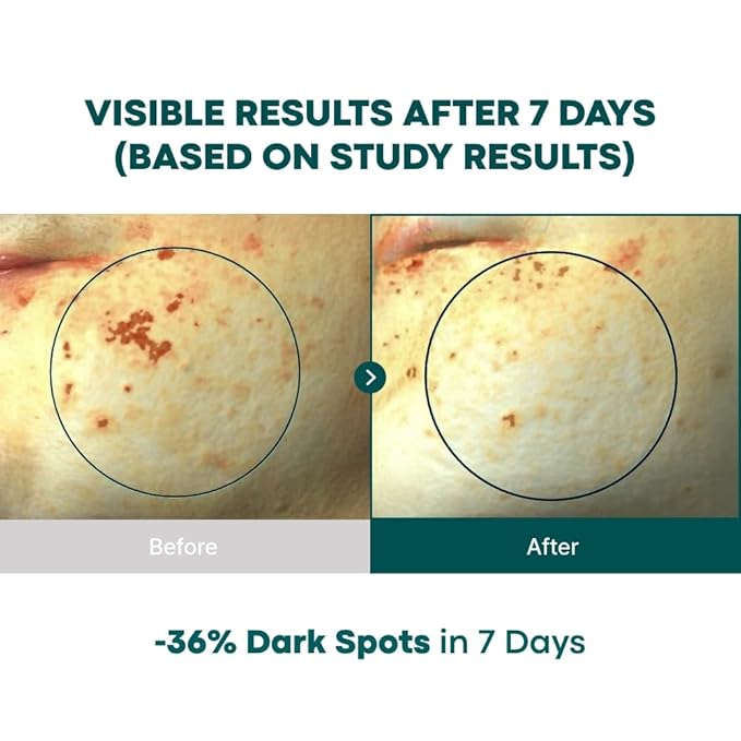 VITA C Capsule Double Shot Ampoule Kit-Korean VitaC Retinol Facial Serum for Dark Spots Uneven Skin Tone, K-beauty Skin Care, 10ml, 0.33 fl. oz.