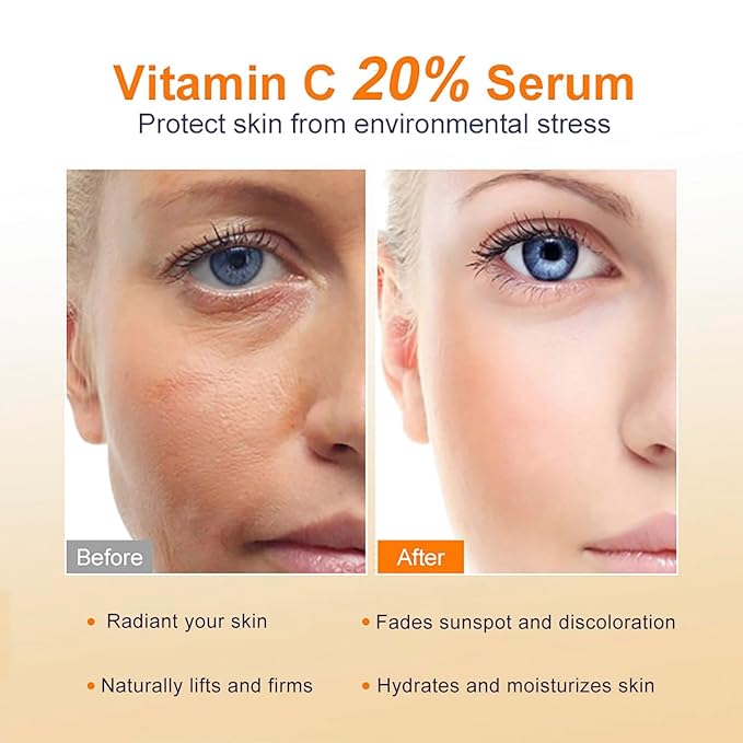 Vitamin C Serum 20%, Professional Vitamin C Face Serum Anti Aging Skin Care, Enhance Skin Radiance Reduce Fine Lines & Wrinkles for Women