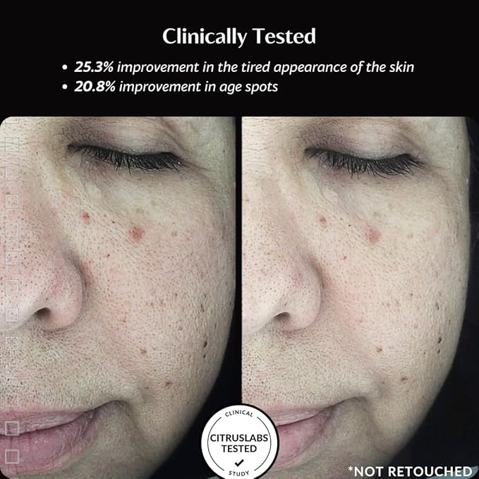 Thursty Skin Hydrating Fluid | Anti-Aging Face Serum with 5 Types of Hyaluronic Acid & Rambutan | Deep Hydration Targets Collagen Skin Renewal Firming & Radiance – Clinically Tested – 30ml