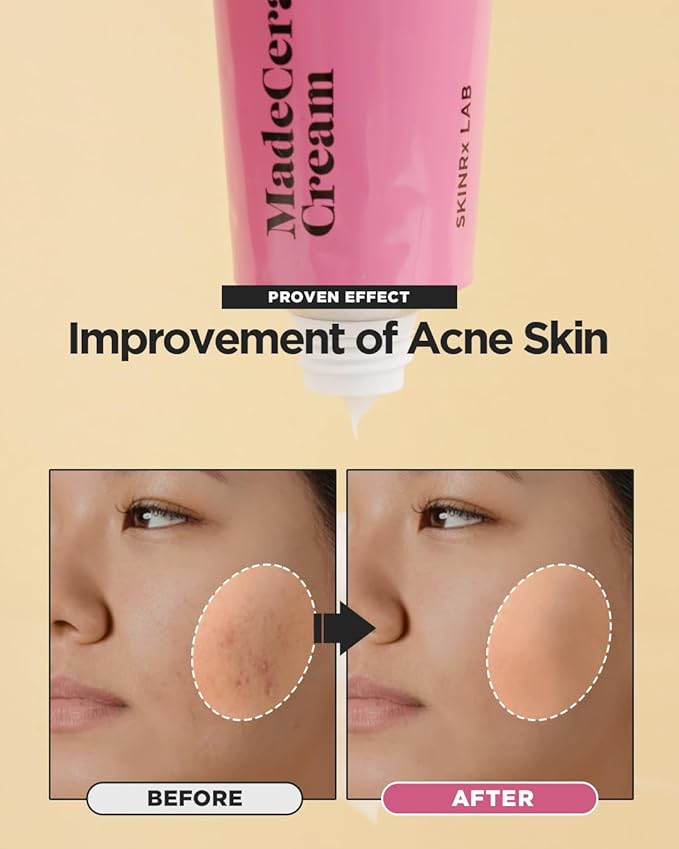 SKINRxLAB Made Cera Cream - Acne & Redness Relief Face Moisturizer, Sebum Control, Improving Skin Barrier with Ceramide and Madecassoside, Anti-Aging and Pore Minimizing Face Cream, 0.5 fl.oz.