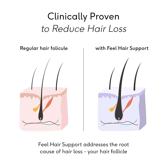 Feel Hair Support, Natural Support for Female Hair loss and Thinning Hair, Vegan, Contains Biotin and Rosemary Oil, 30 Capsules