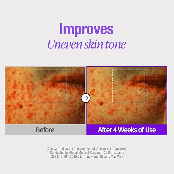 GOODAL Green Tangerine Vita C Niacinamide 10 Toning Ampoule - Facial Serum for Natural Glow, Daily Use, Pore Minimizer for Face, Hydrating, Korean Skincare, K Beauty (30ml/1.01 fl.oz.)