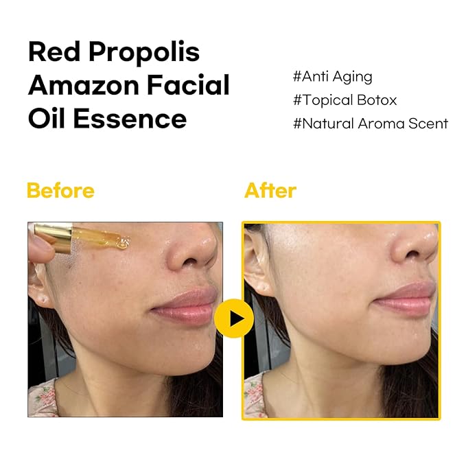 BBH Amazon Red Propolis | Organic Jojoba Oil Essence| All Skin Types | Anti-Aging | Treats Fine Lines| Dermatologist Tested | K- Beauty, Vegan, korean skincare| 1 fl oz