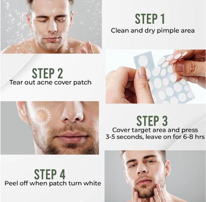 Clear Pimple Patches- Hydrocolloid Fast Acting Pimple Patch w/ Salicylic Acid & Tea Tree Oil Fights Breakouts & Blemishes. Acne Spot Treatment for Face- 108 Ct.