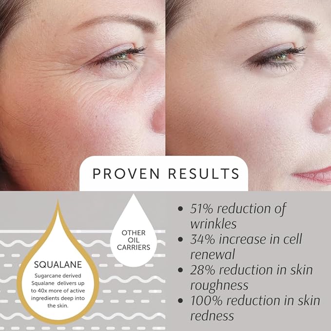 Puur Ingrid - Squalane Absolute - EWG VERIFIED, for Skin Texture, Tone, and Youthful Radiance, 30ml/1oz