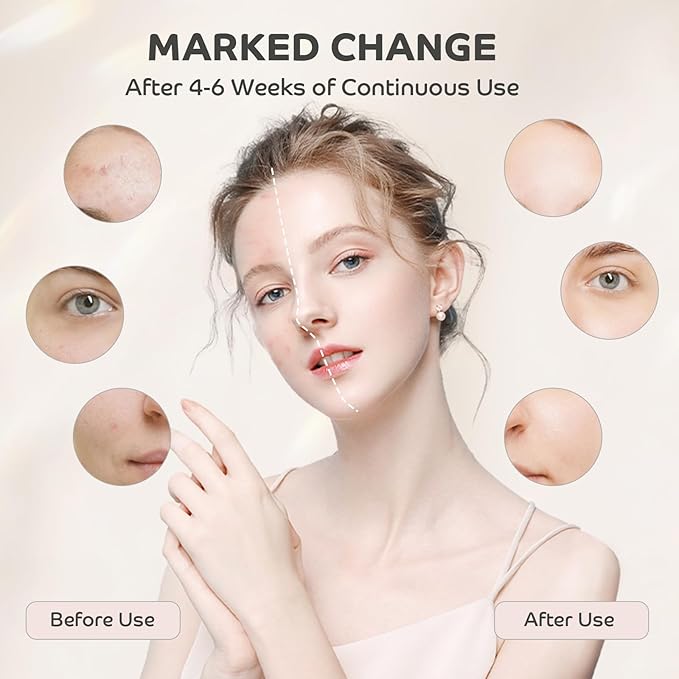 Red Light Therapy for Face, Two Drive Modes Red Light Mask with 850nm Near-Infrared for Travel Home Use