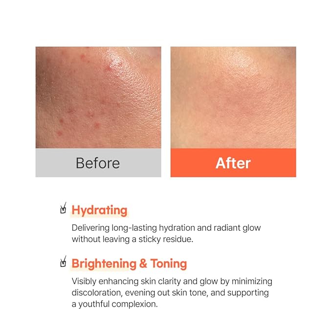 Hanskin Vitamin C Glow Serum with Ascorbic Acid, Dark Spot Remover for Face, Toning, Illuminates for Glowing Skin, Korean Skin Care [30ml]