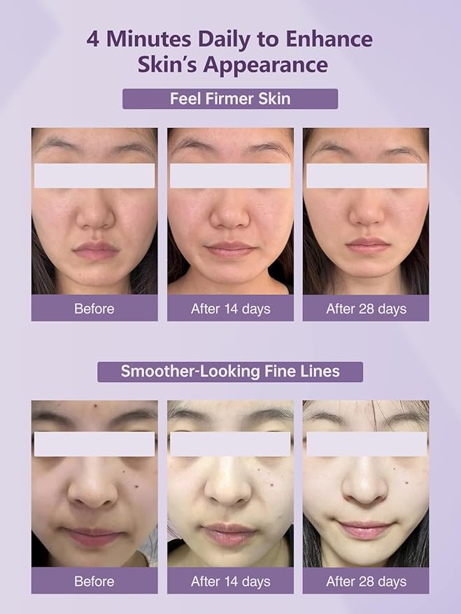 6-in-1 Age-Defying - Eye, Face & Neck Lift & Firm, 5-Color Light Therapy for Face with Microcurrent, Vibration, Heat & Cooling, Skin Care Tool for Youthful & Tightening Skin,Purple