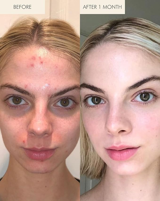 MARA - 1.2% Clean Retinol Face Oil for Anti-Aging + Wrinkles with Algae + Green Tea | Vitamin-Rich Serum to Plump Skin Overnight, For All Skin Types (0.5 fl oz | 15 ml; Travel Size)