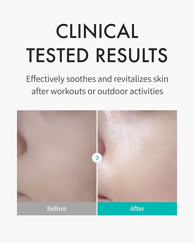 REJURAN® c-PDRN® Korean Skin Care Bundle – Turnover Ampoule Serum (1.01 fl oz) & Skin Protection Hydrating Sheet Mask (5-Pack) for Firming, Soothing & Repairing Irritated Skin with Salmon DNA