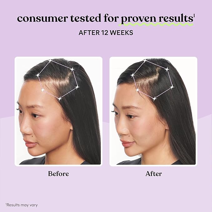 Lemme Grow Hair Growth Supplement for Women, Clinically Proven Keratin Complex for Visibly Thicker Hair and Scalp Coverage, Reduced Shedding, Nourish Thinning Hair - 1 Month Supply