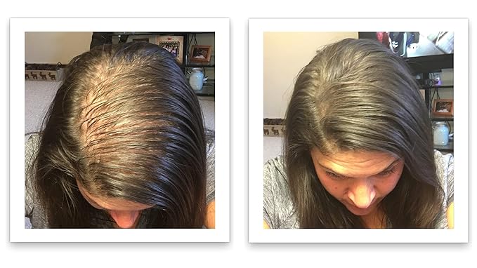 Hair Loss Concealer. Cover Bald Spot and Thinning Hair Instantly. Make Thin Hair Look 10X Fuller. All-Natural Hair Building Fiber. Trial Size (10-Day Supply). Dark Brown