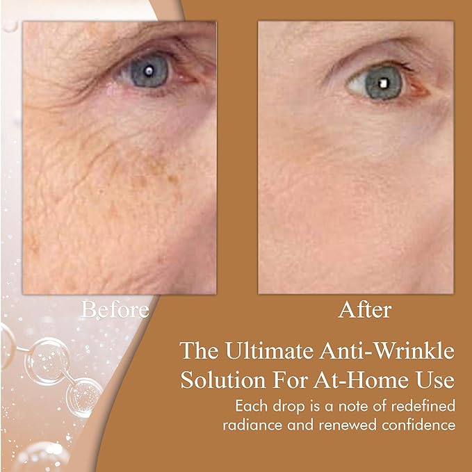 SkinPro Retinol Serum for Face - Anti Aging Face Serum for Dark Spots, Fine Lines and Wrinkles, 3% Retinol Complex Skin Renewing and Resurfacing Night with Hyaluronic Acid - 30 ml
