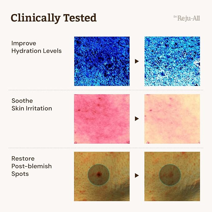 Repair & Tone Duo: Advanced PDRN Rejuvenating Cream + Advanced Retino-Mela Serum - Face Moisturizer & Retinol Serum for Firming & Smooth Skin, Korean Pharmacy Anti-Aging Skin Care