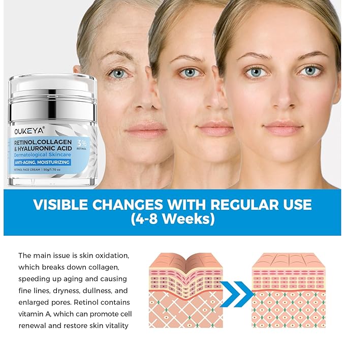 OUKEYA Retinol Cream for Face,Wrinkle for Women, Anti-Aging Moisturizer, Neck Firming & Décolleté, Moisturizer Face Cream, Day Night with 5% Hyaluronic Acid