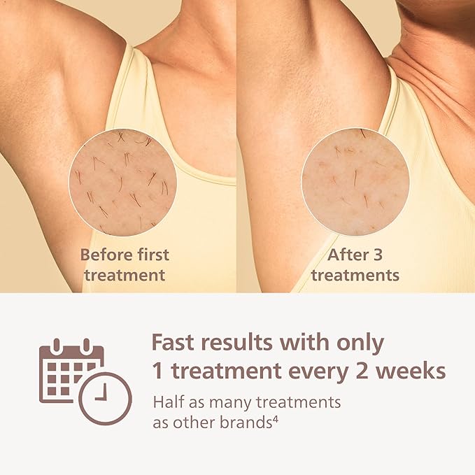 Philips Lumea 8000 Series IPL Hair Removal Device - Permanent Visible Hair Reduction Done at Home, SenseIQ Technology, 2 Attachments for Body & Face, for Women & Men, BRI932/03