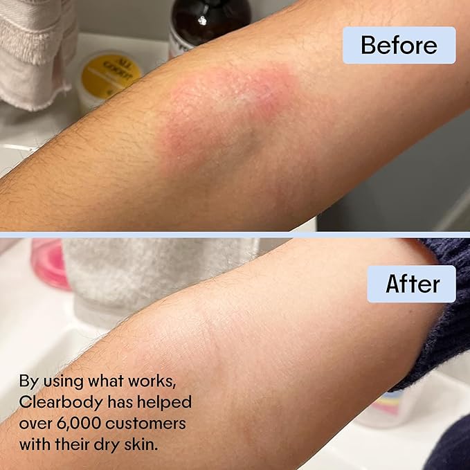 Clearbody Organics Manuka Honey Cream - 2 fl oz, Pack of 1 - Soothing Eczema Cream - Deep Hydration with Colloidal Oatmeal - Instant Manuka Relief for Dry, Itchy Skin