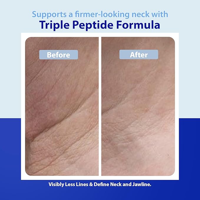 Dr. Denese Triple Strength Neck Wrinkle Smoother 4 oz – Firming Cream with Triple Amount of Peptides Compared to Industry Standards – Retinol & Hyaluronic Acid for Hydrating Power - Paraben Free