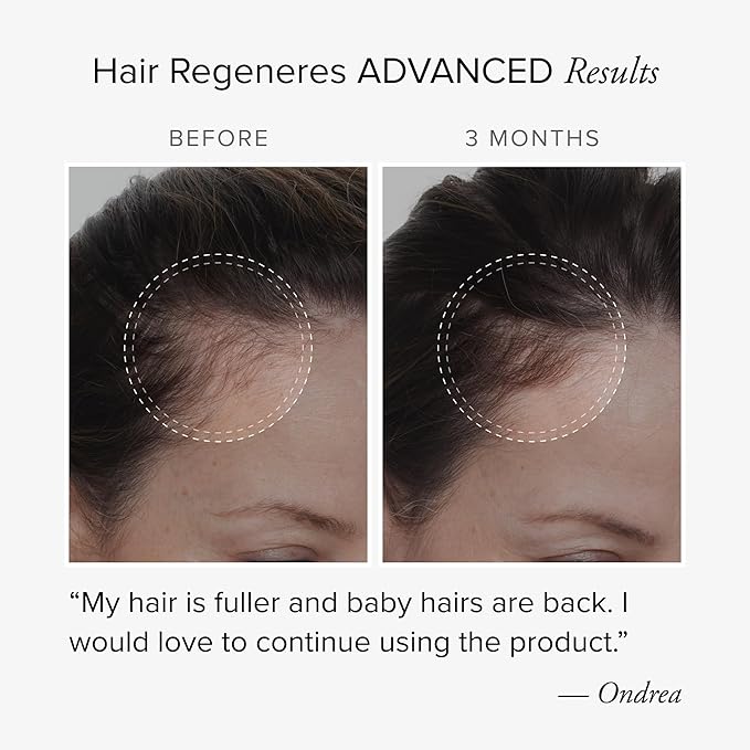 Hair Regeneres Advanced - Reduces Hair Shedding & Breakage - Promote Scalp Health - Stress-Related Hair Loss – Ashwagandha and Marine Collagen, 90 Ct