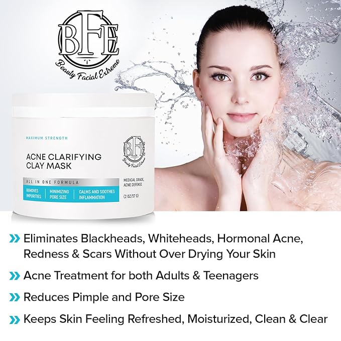 Acne Treatment Clay Mask- Clears Away Clogged Pores, Blackhead & Whitehead Pimples, Blemishes, Scars & Oily Skin for Face & Body. Ingredients Including Sulfur, Bentonite, Kaolin & Jojoba Oil.