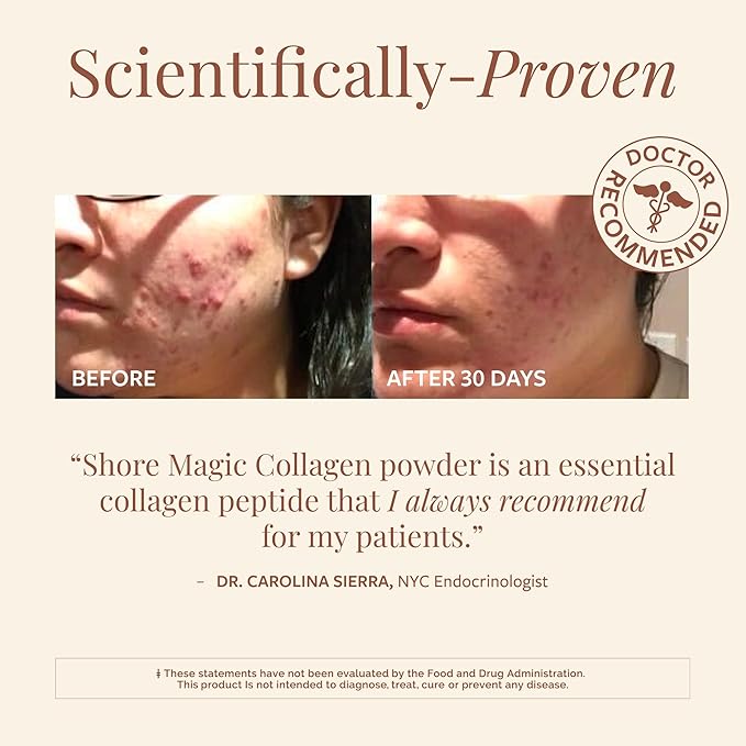 Premium Marine Collagen Powder – Hydrolyzed Type I, II, III & IV Peptides from Wild Fish for Skin, Hair, Nails & Joints, 14 Servings