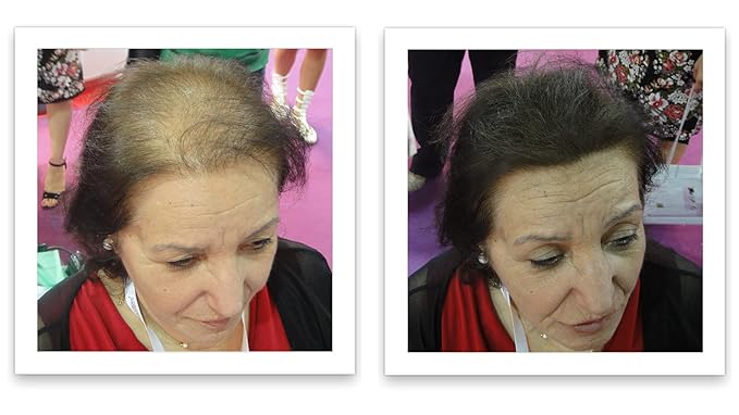 Hair Loss Concealer. Cover Bald Spot and Thinning Hair Instantly. Make Thin Hair Look 10X Fuller. All-Natural Hair Building Fiber. Trial Size (10-Day Supply). Dark Brown