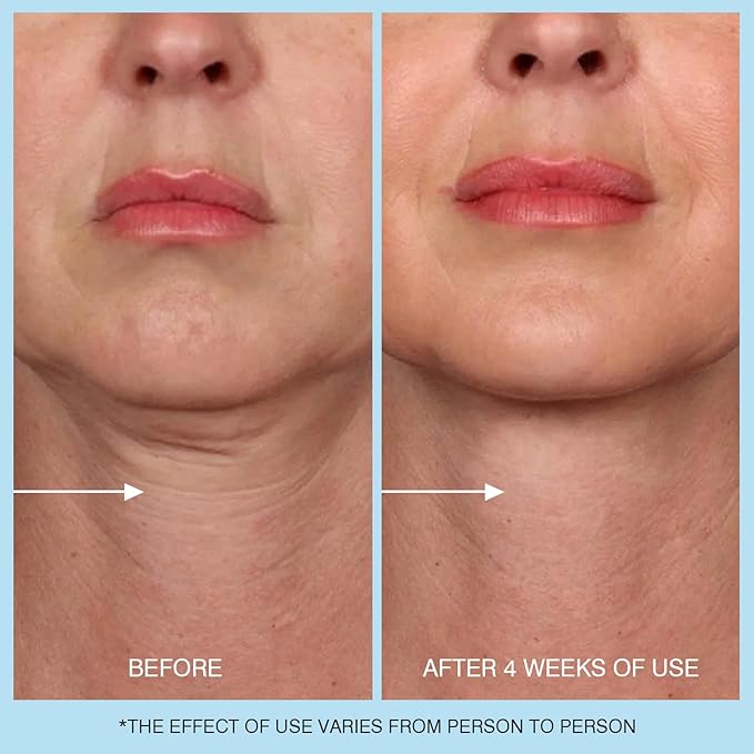 Retinol Neck Cream, Hyaluronic Acid and Caffeine Enriched Neck Firming Cream to Minimize Fine Lines & Dullness - 3-in-1 Moisturizing Cream for Neck, Chest and Face (50 ml/1.7 oz)