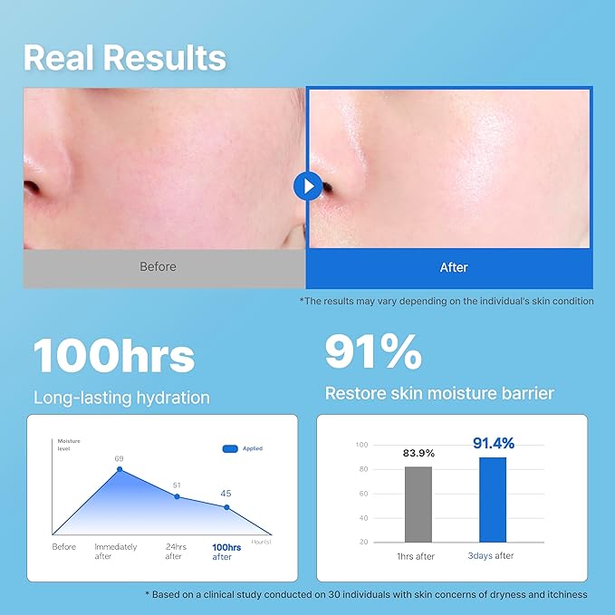 Illiyoon Ceramide Ato Concentrate Cream | Moisturizer for Dry & Sensitive Skin, 100hr Lasting Hydration, For Face & Body, Gentle for Infants, Moisture Barrier Repair, Vegan Certified, 6.76 fl.oz.