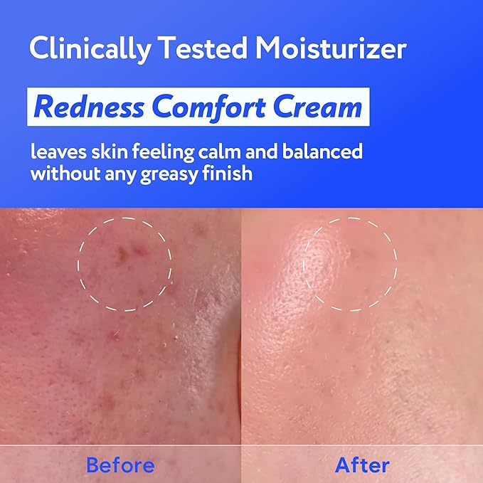 Coconut Hydro Barrier Cream | Soothing & Barrier Repair Moisturizer with Panthenol, Ceramide & Squalane | Non-Greasy, Fragrance Free Capsule Cream Korean Skin Care (80ml / 2.7 fl oz)