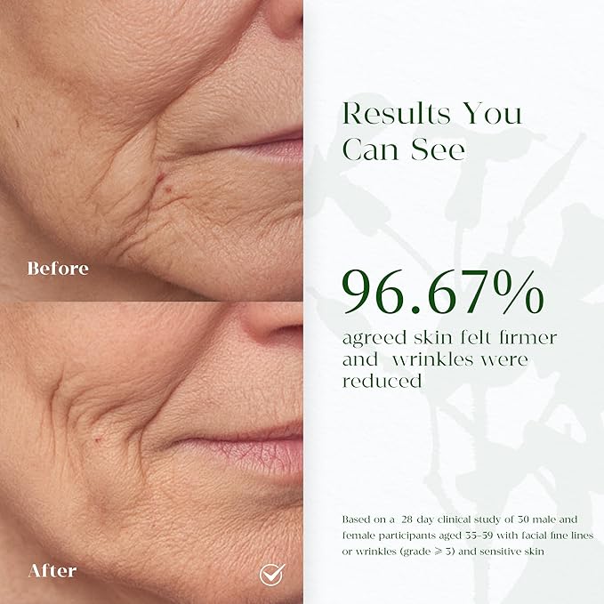 Organic Anti Aging Face Oil, 100% Natural Hydrating Brightening Serum, Squalane + Sea Buckthorn + Rosehip Oil, Vitamin E, Retinol, Antioxidant Gua Sha Oil for Sensitive & Dry Skin