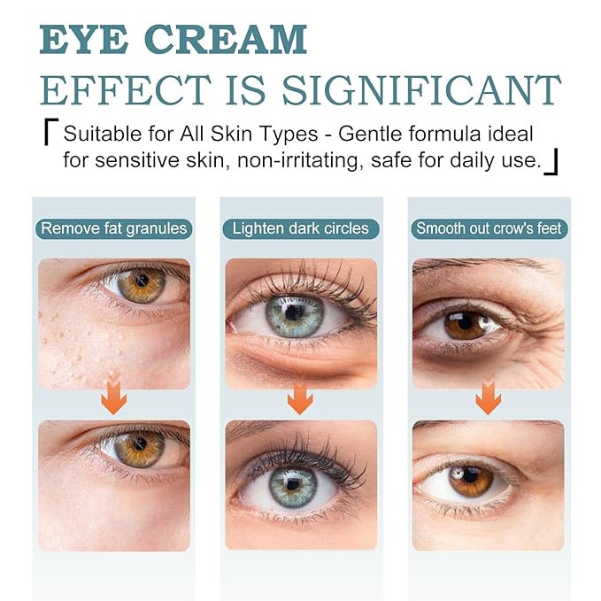 Temporary Tightener Eye Cream-Instantly Reduces Under- Bags, Dark Circles & Wrinkles, Anti-Aging with Retinol & Hyaluronic Acid, Under Eye Creams Suit Women Men Firm Smooth firming Non-Greasy-A1A1A1