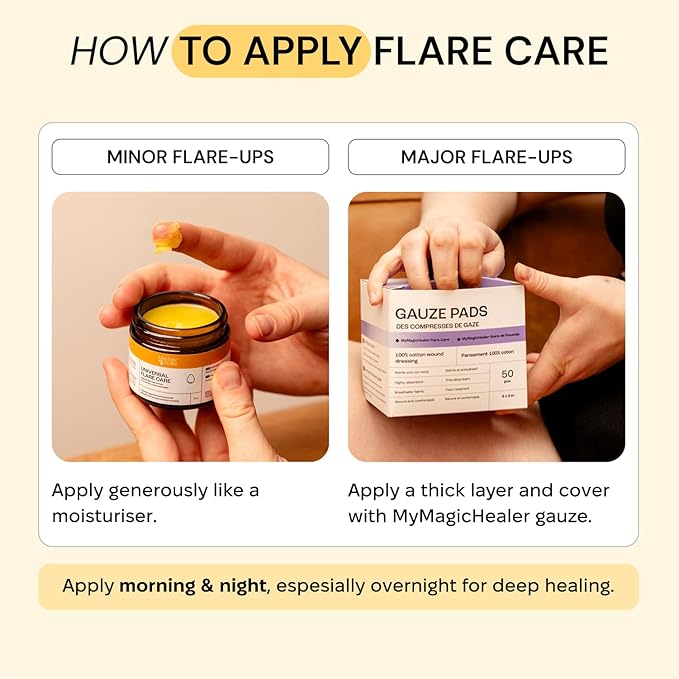 MyMagicHealer Universal Flare Care | Essential Oil Free | Relief for Rashes, Eczema, Psoriasis, Hidradenitis Suppurativa, Impetigo, Dermatitis, Wound Care, Sensitive Skin w/Propolis & Egg Yolk 4 oz
