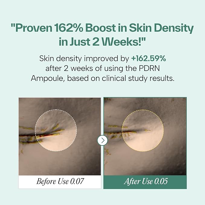 PDRN 73 Serum 730000ppm Plant-Based Kbeauty with Bakuchiol and Fast Absorption | Korean Facial Serum for Women, Personal Care, Niacinamide, Hyaluronic Acid, Glutathione (1.01 fl.oz）