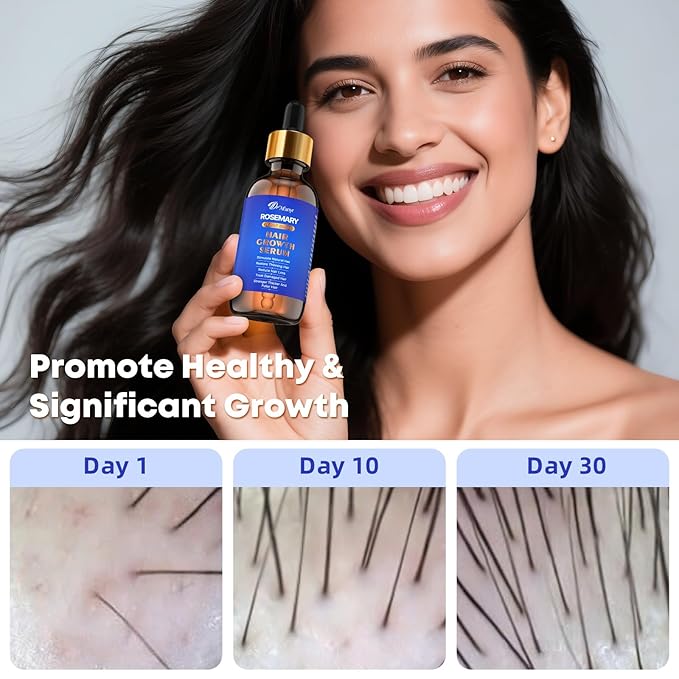 Hair Growth Serum with Rosemary Oil & Saw Palmetto - 100% Natural Plant-Based Formula to Stimulate Follicles, Revive Roots for Visibly Thicker Fuller Hair, Reduce Shedding and Loss For Men & Women