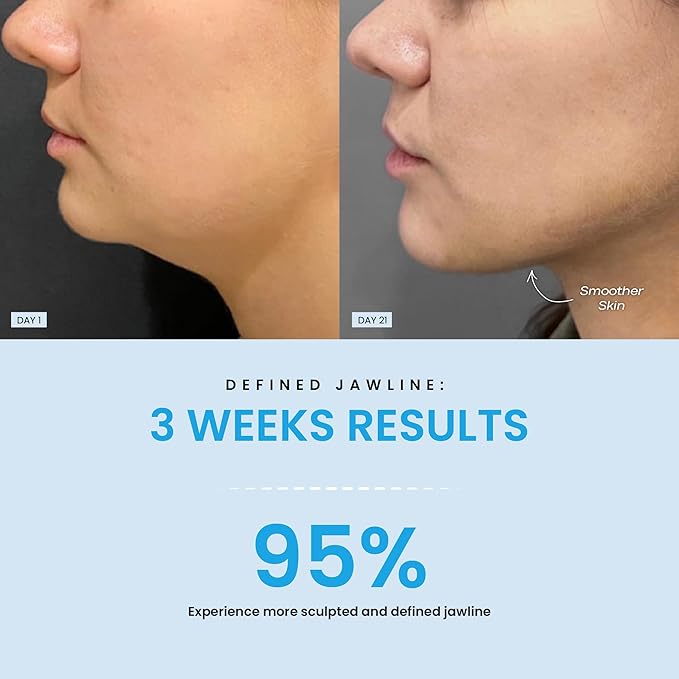 Red Light Therapy Face & Neck Massager – LiftLab 3-in-1 LED Sculptor with Blue & Green Modes – Jawline & Double Chin Tightening, Wrinkle & Spot Care -Improved Battery