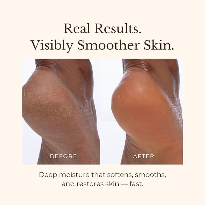 Juara - Candlenut Body Creme | Moisturizing Lotion | Dry Skin Hydration | Skin, Hands & Feet Cream | Soothing Skincare Balm | Cruelty Free, Paraben, Sulfate Free, Vegetarian | 7.5 oz