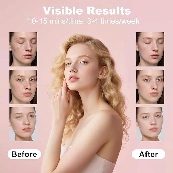 Red Light Therapy for Face, Portable Led Face Mask Light Therapy with Rechargeable Remote, 7+1 Color Near-Infrared Red Light (NIR), Red Light Therapy at Home (Pink)