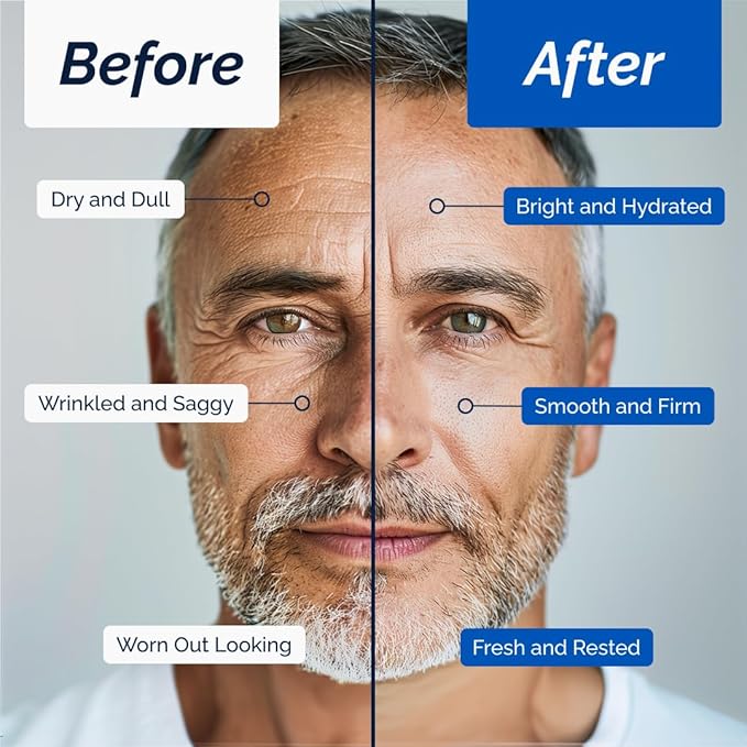 Face Cream – Moisturizer with Retinol and Hyaluronic Acid, Refreshing Effect, Reduces Wrinkles and Dark Spots, Improves Skin Elasticity and Radiance