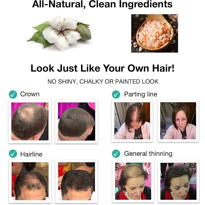 Hair Building Fiber. Cover Bald Spot and Thinning Hair Instantly. 10X Fuller Hair. All-Natural, Organic Hair Loss Concealer. Trial Size (10-Day Supply). Medium Brown